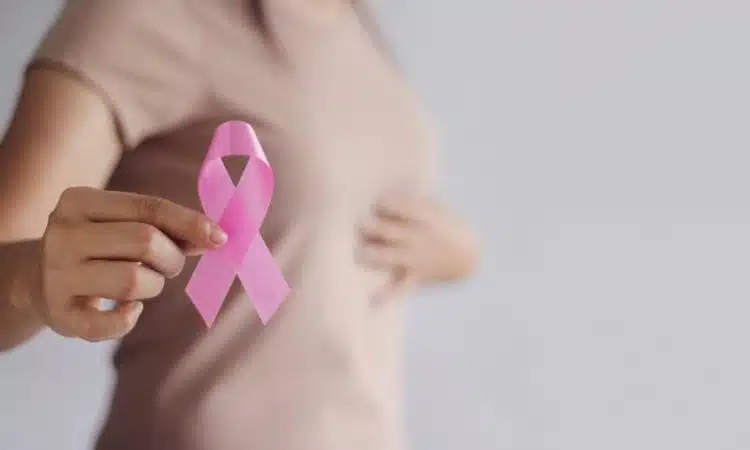 Particularités du cancer du sein de stade 3